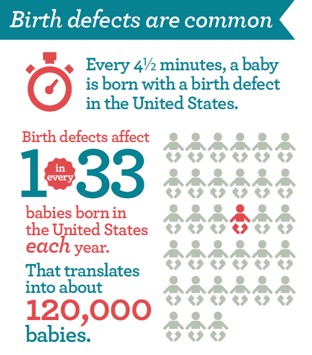 birth defects are common infographic